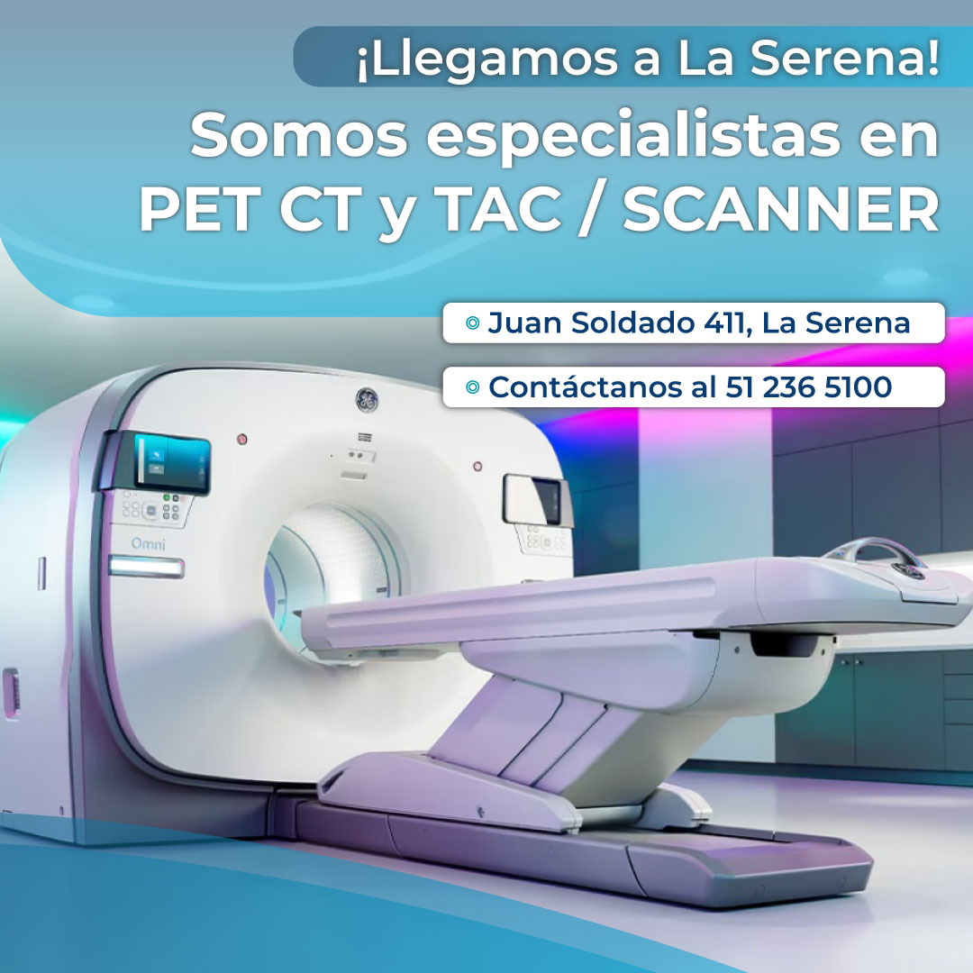 ¡Llegamos a La Serena! Somos Especialistas en PET CT y TAC/SCANNER